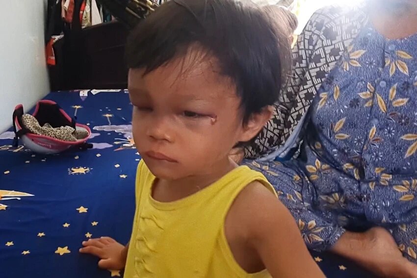 lam ro vu be gai 4 tuoi nghi bi cha nuoi danh dap da man o ca mau lam ro vu be gai 4 tuoi nghi bi cha nuoi danh dap da man o ca mau