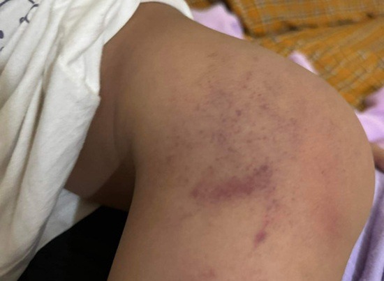buoc thoi viec nu nhan vien co so giu tre bao hanh be gai 3 tuoi o binh dinh buoc thoi viec nu nhan vien co so giu tre bao hanh be gai 3 tuoi o binh dinh