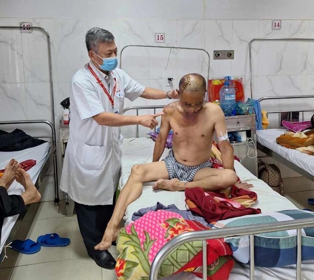 bat giu ma men vo co chan danh nguoi di duong chan thuong so nao 2 bat giu ma men vo co chan danh nguoi di duong chan thuong so nao 2
