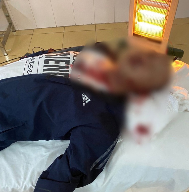 dieu tra vu con no bi nhom con do danh chan thuong so nao vao ngay tet 2
