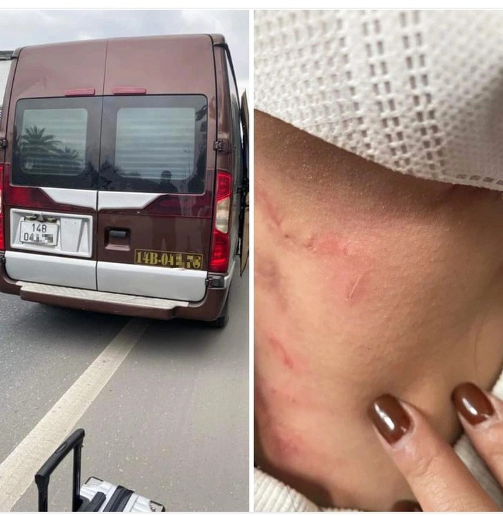 vu nha xe bi to hanh hung bo roi khach giua cao toc tai xe khai gi 