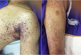 ngay 26 11 tang benh nhan 941669460436 ngay 26 11 tang benh nhan 941669460436