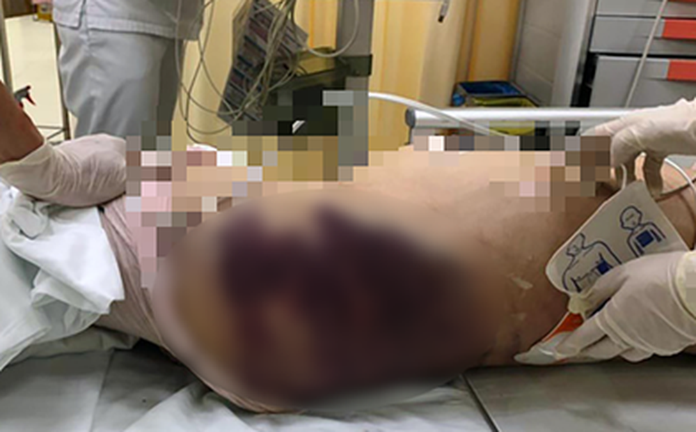 vu be gai 8 tuoi nghi bi di ghe danh toi chet ca nam me ruot khong duoc gap con vu be gai 8 tuoi nghi bi di ghe danh toi chet ca nam me ruot khong duoc gap con