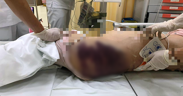 vu be gai 8 tuoi bi bao hanh tu vong ban be deu nghe thay tieng la het trong buoi hoc online cuoi cung vu be gai 8 tuoi bi bao hanh tu vong ban be deu nghe thay tieng la het trong buoi hoc online cuoi cung