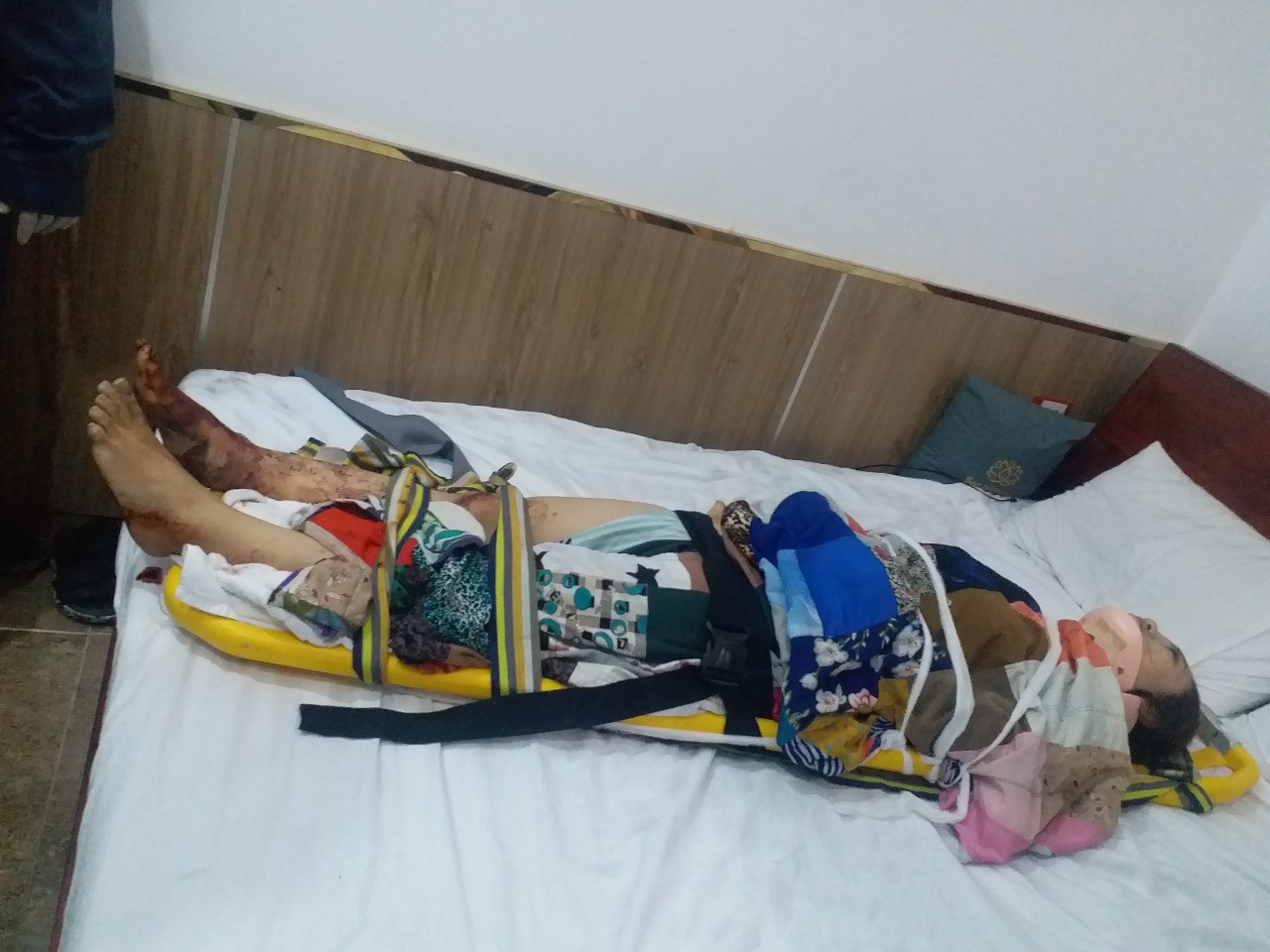 tp hcm thang may khach san bat ngo roi tu do tu tang 4 co gai phai nhap vien cap cuu
