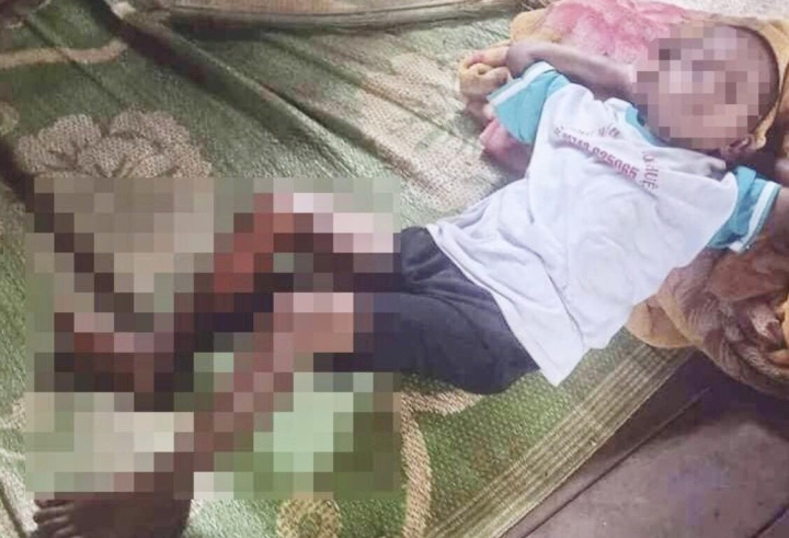 vu be trai 8 tuoi o dak lak bi dot bong chan cong an thong tin ban dau vu be trai 8 tuoi o dak lak bi dot bong chan cong an thong tin ban dau