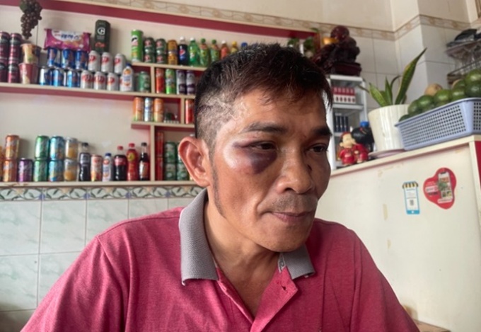 vu con trai danh ca che linh bi danh hoi dong he lo nguyen nhan vu con trai danh ca che linh bi danh hoi dong he lo nguyen nhan