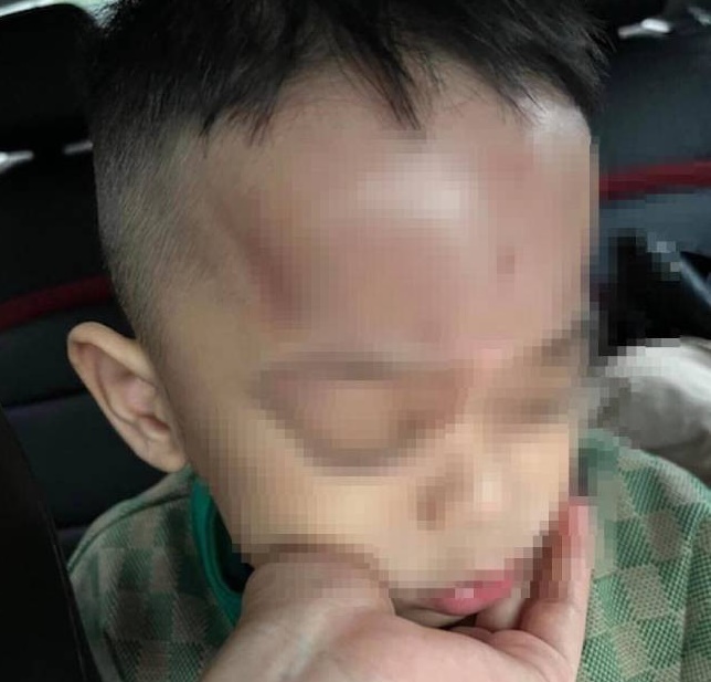 nghi an be 4 tuoi bi bao hanh tai truong mam non o da nang nghi an be 4 tuoi bi bao hanh tai truong mam non o da nang