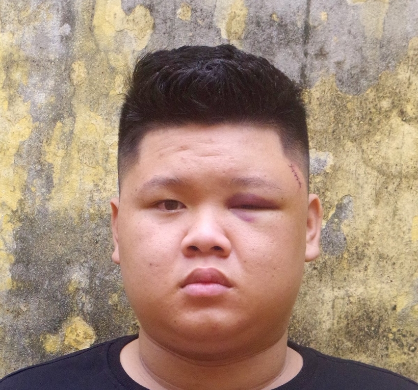 giai quyet no bang dao thanh nien 19 tuoi bi khoi to