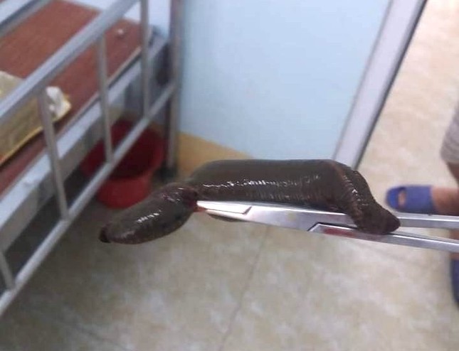 di mo oc duoi ao cu ong bi con dia dai 15cm chui vao duong vat di mo oc duoi ao cu ong bi con dia dai 15cm chui vao duong vat