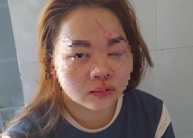 xem xet ky luat thay giao danh vo phai nhap vien xem xet ky luat thay giao danh vo phai nhap vien