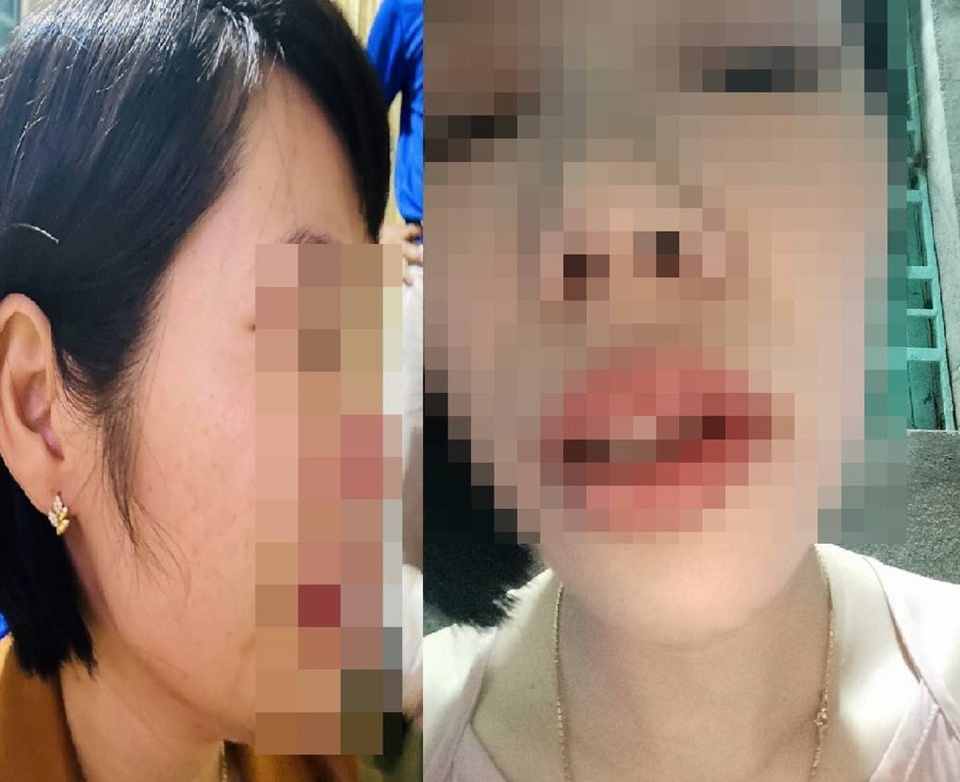 vu phu huynh xong vao nha danh co giao ubnd tinh dak nong chi dao khan vu phu huynh xong vao nha danh co giao ubnd tinh dak nong chi dao khan