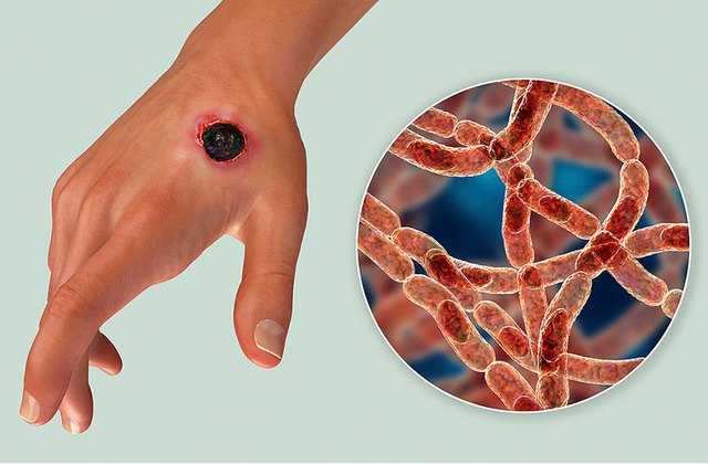 bo y te cap nhat thong tin moi nhat ve tinh hinh dich benh than tren nguoi