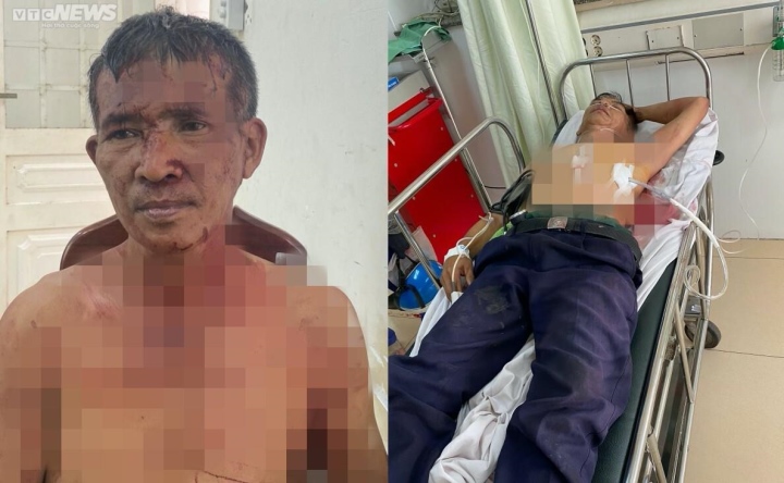 lam ro vu nhan vien bao ve ngan hang dam dong nghiep thuong tich2
