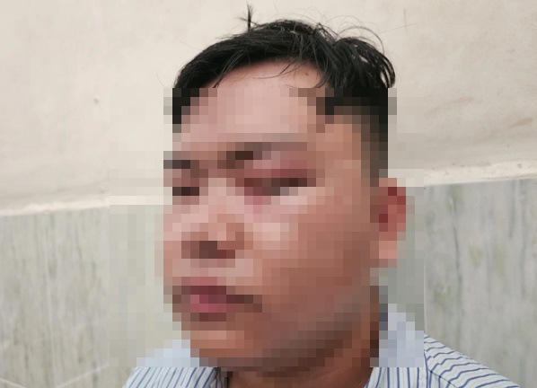 vu nam thanh nien ton thuong mat do va trung gay csgt dien bien moi nhat