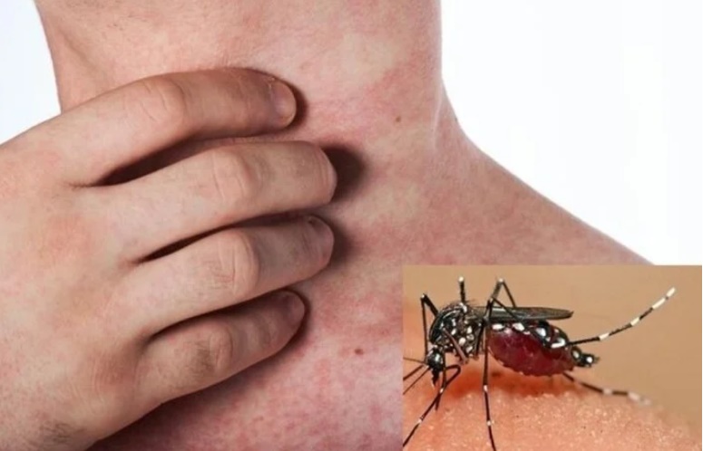 viet nam se tiem thu nghiem vaccine sot xuat huyet viet nam se tiem thu nghiem vaccine sot xuat huyet
