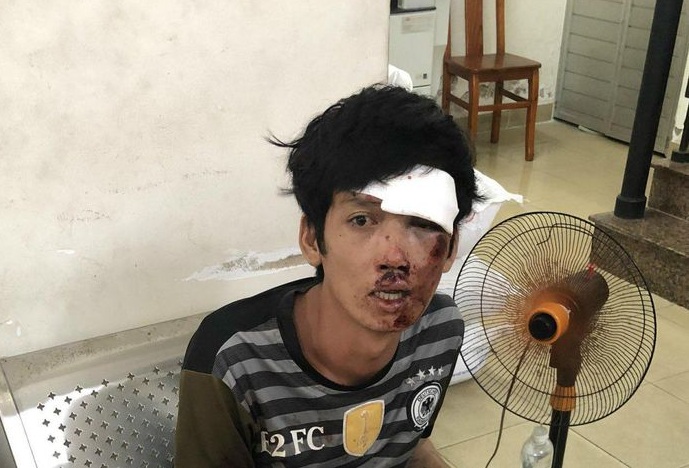 chay tron sau khi cuop tai san ten cuop tong phai dai phan cach bat tinh nhan su dspl
