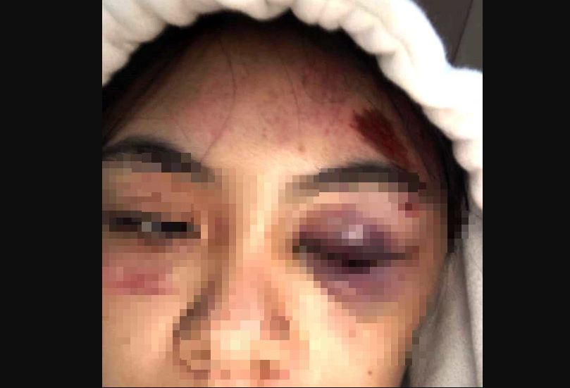nu sinh bi ban danh hoi dong den da chan thuong dspl