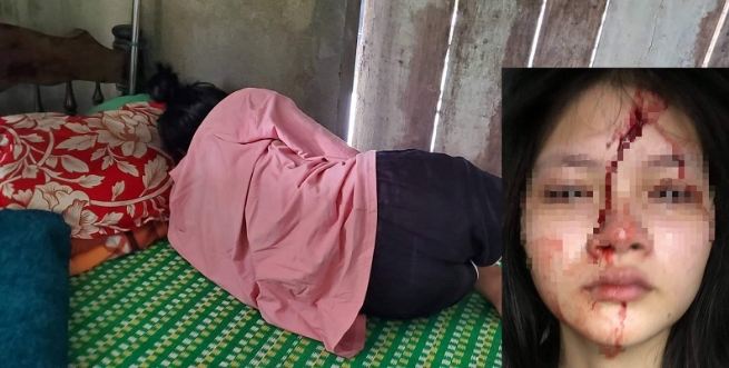 thua thien hue nu sinh lop 10 bi ban dung mu bao hiem danh chan dong nao dspl