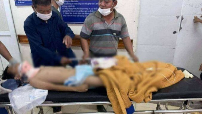 nam sinh lop 3 roi tu tang 2 xung dat dspl