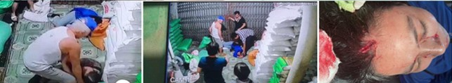 hai phong dieu tra vu bo chong danh con dau chan thuong so nao 2 hai phong dieu tra vu bo chong danh con dau chan thuong so nao 2