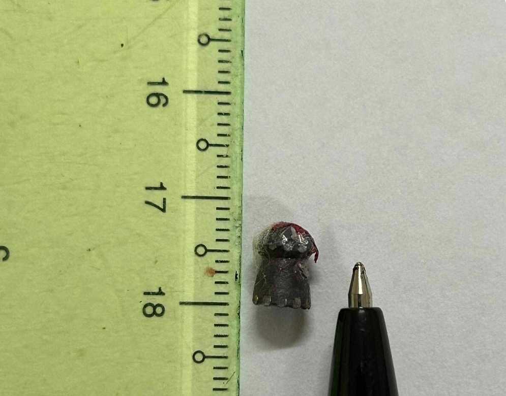 nguoi dan ong noi bi trung dan lac va su that bat ngo phia sau 1 nguoi dan ong noi bi trung dan lac va su that bat ngo phia sau 1