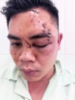 da lat bo bat ngo bi danh da man 3 chau be gao khoc cau cuu moi nguoi da lat bo bat ngo bi danh da man 3 chau be gao khoc cau cuu moi nguoi