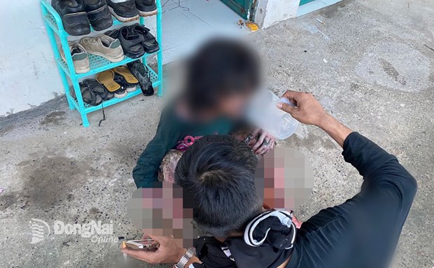 lam ro nghi an phong hoa do ghen tuong mu quang khien nhieu nguoi bi bong nang