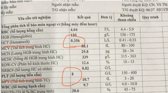muc do nguy hiem cua tinh trang co dac mau voi benh nhan sot xuat huyet muc do nguy hiem cua tinh trang co dac mau voi benh nhan sot xuat huyet