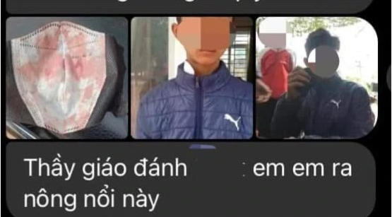 xac minh nguyen nhan thay giao the duc danh nam sinh chay mau mui o dak lak xac minh nguyen nhan thay giao the duc danh nam sinh chay mau mui o dak lak