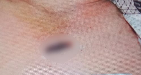 cong an yeu cau kham nghiem tu thi nguoi dan ong tu vong voi nhieu nghi van