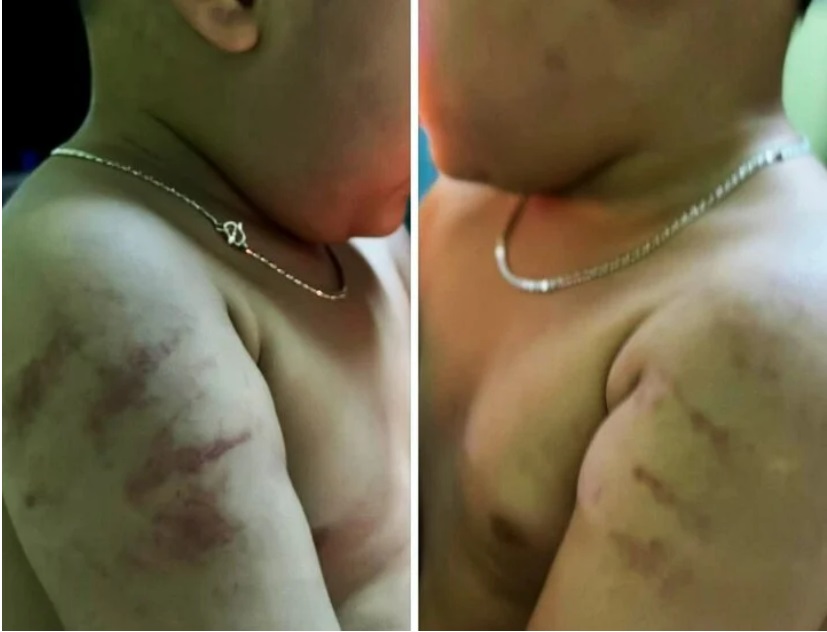 xon xao thong tin be gai 4 tuoi nghi bi giao vien bao hanh nhu thoi trung co3 xon xao thong tin be gai 4 tuoi nghi bi giao vien bao hanh nhu thoi trung co3