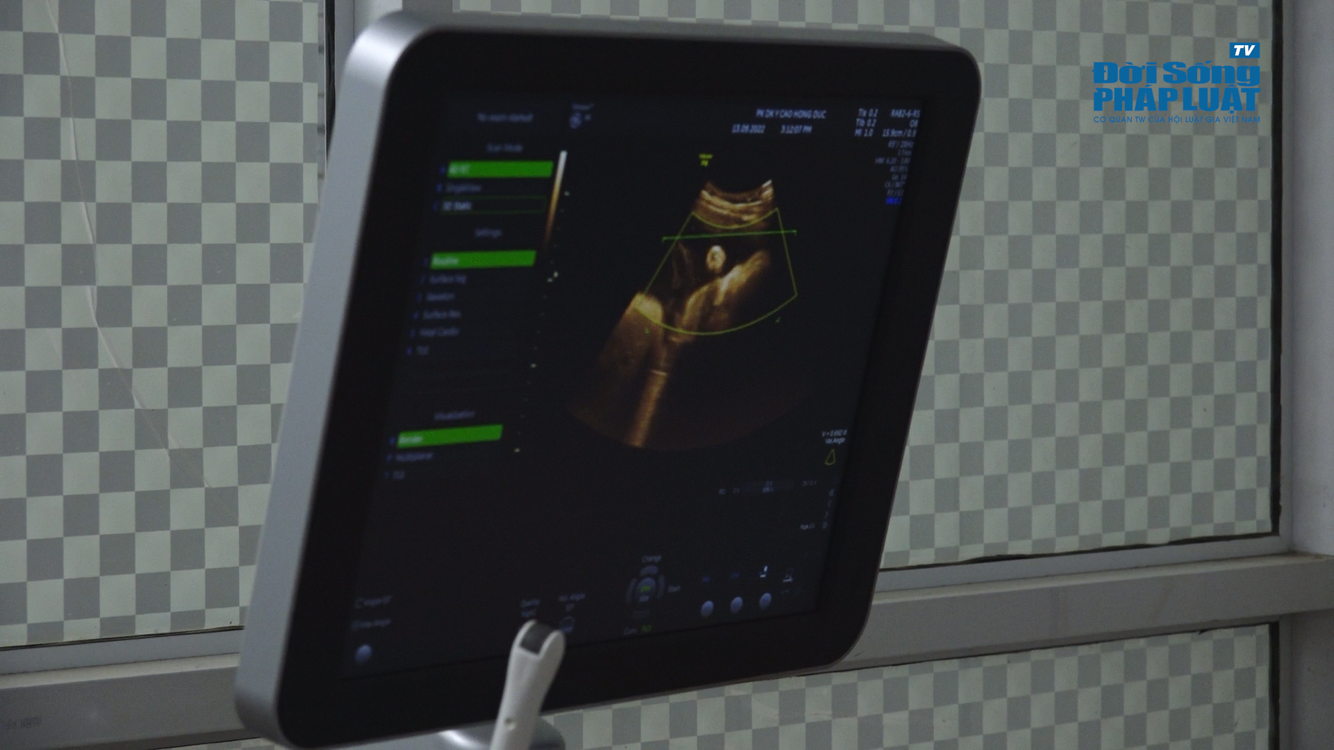 final phong kham da khoa00014312still009