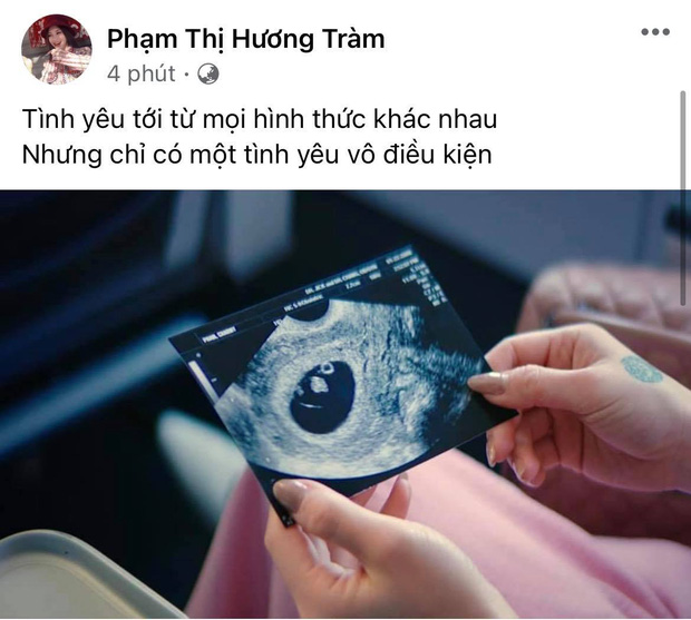 tin tuc giai tri moi nhat ngay 15 5 nghi van huong tram mang thai sau 2 nam sang my du hoc1