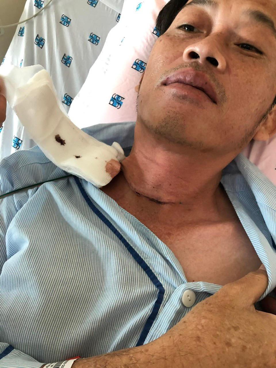 nsut hoai linh tiet lo phai phau thuat ung thu tuyen giap cach day vai thang1 nsut hoai linh tiet lo phai phau thuat ung thu tuyen giap cach day vai thang1