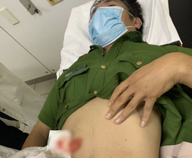 thua thien hue mot can bo cong an bi dam trong luc lam nhiem vu 2 thua thien hue mot can bo cong an bi dam trong luc lam nhiem vu 2