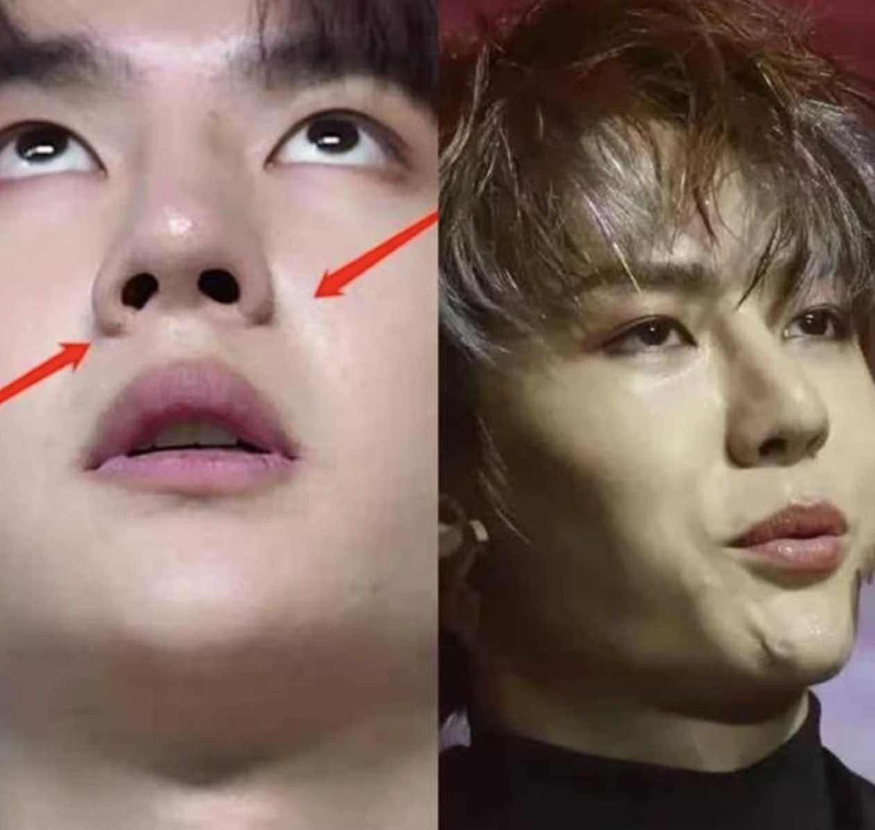sao nam hoa ngu tung vuong nghi van phau thuat tham my vuong nhat bac tieu chien duoc goi ten3 sao nam hoa ngu tung vuong nghi van phau thuat tham my vuong nhat bac tieu chien duoc goi ten3