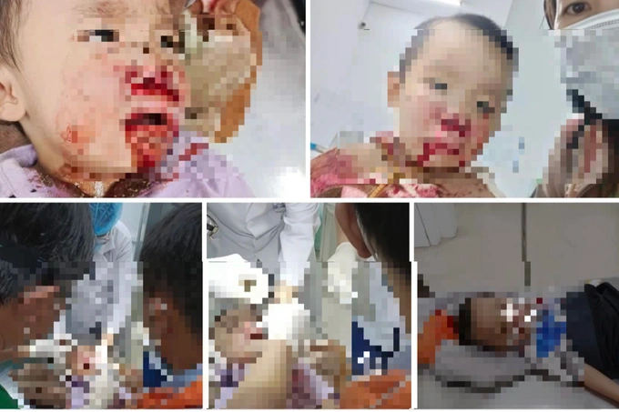 vu nguoi me to csgt danh trung mat con trai pho giam doc cong an tinh tien giang noi gi dspl 