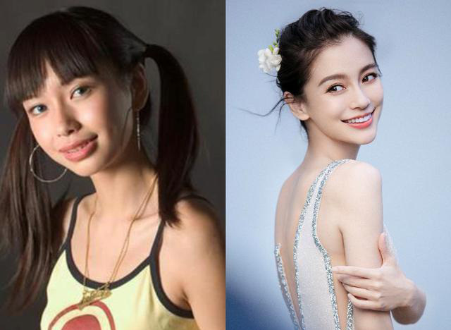 tin tuc sao hoa ngu moi nhat ngay 10 11 2022 angelababy kien benh vien vi loat anh thoi chua chinh rang1