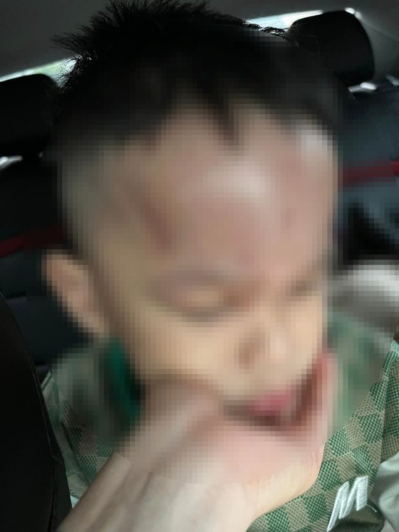 da nang xac minh vu phu huynh phan anh tre bi bao hanh tai truong mam non da nang xac minh vu phu huynh phan anh tre bi bao hanh tai truong mam non
