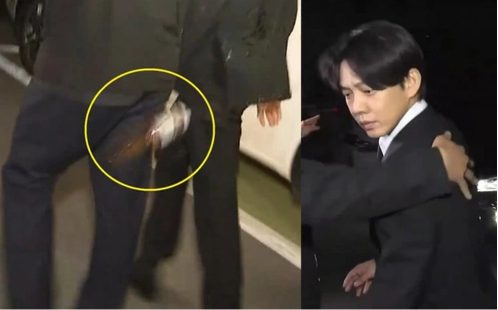 su dung ma tuy yoo ah in nhan hau qua khon luong2