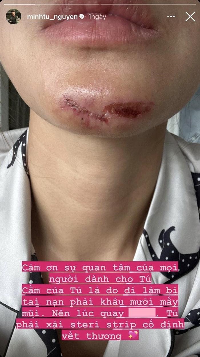 khan gia xot xa khi minh tu phai khau hon muoi mui duoi cam2 khan gia xot xa khi minh tu phai khau hon muoi mui duoi cam2