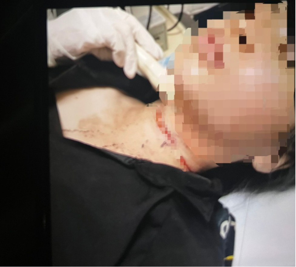 binh duong nguoi phu nu giau vang dem di ban roi trinh bao bi cuop3 binh duong nguoi phu nu giau vang dem di ban roi trinh bao bi cuop3