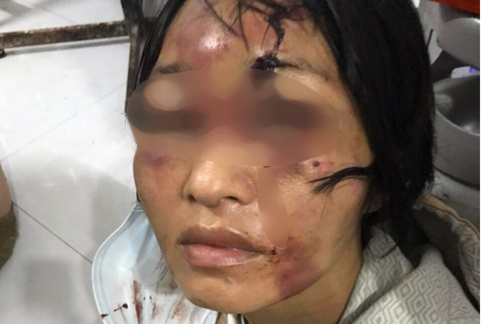 bat tam giam ga chong ho danh dap tan bao nguoi phu nu va be gai 8 tuoi tai an giang2 bat tam giam ga chong ho danh dap tan bao nguoi phu nu va be gai 8 tuoi tai an giang2