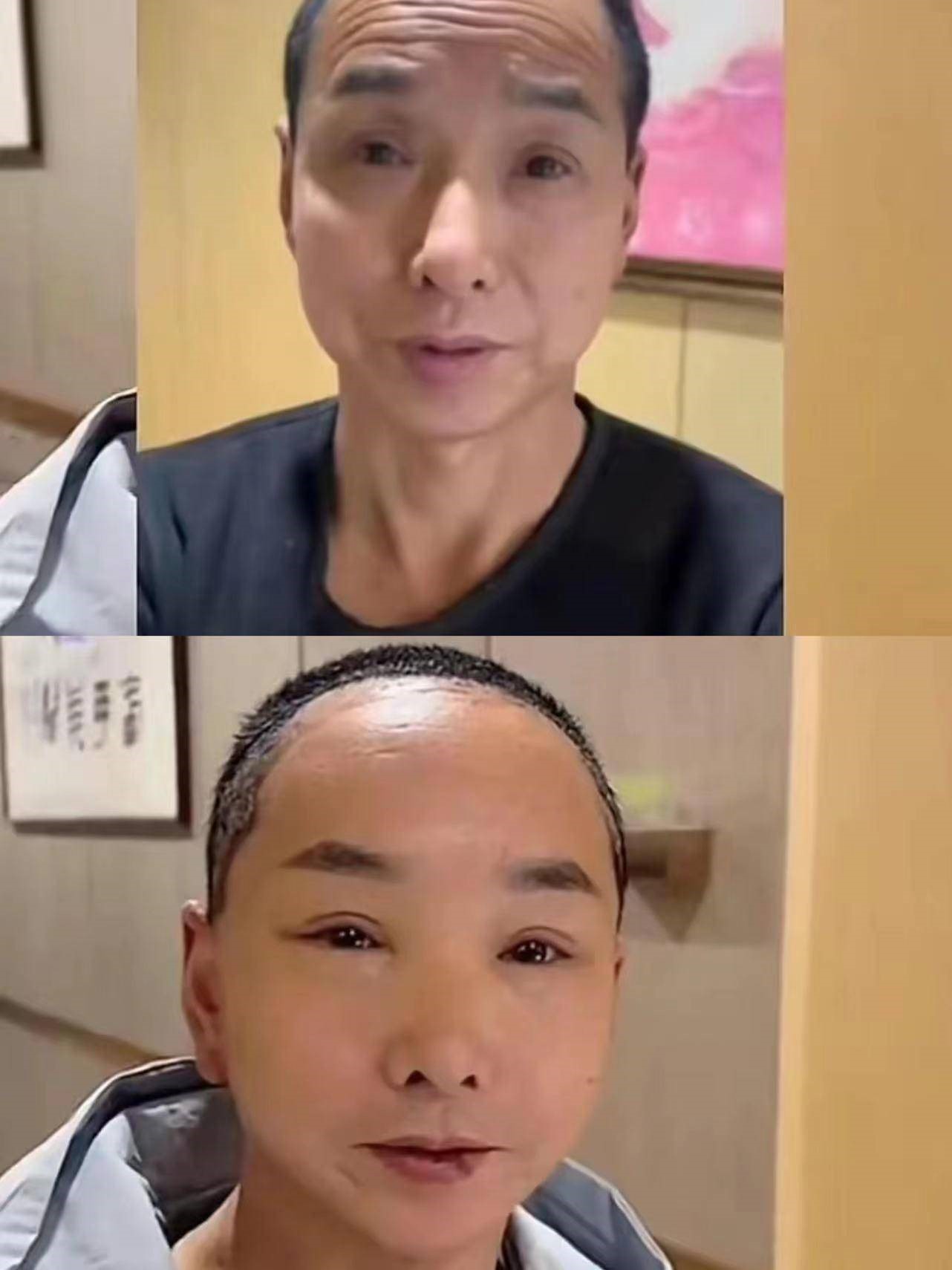 bi nham thanh ong noi cua con nguoi dan ong chi tien khung de cang da mat va cai ket gay choang bi nham thanh ong noi cua con nguoi dan ong chi tien khung de cang da mat va cai ket gay choang