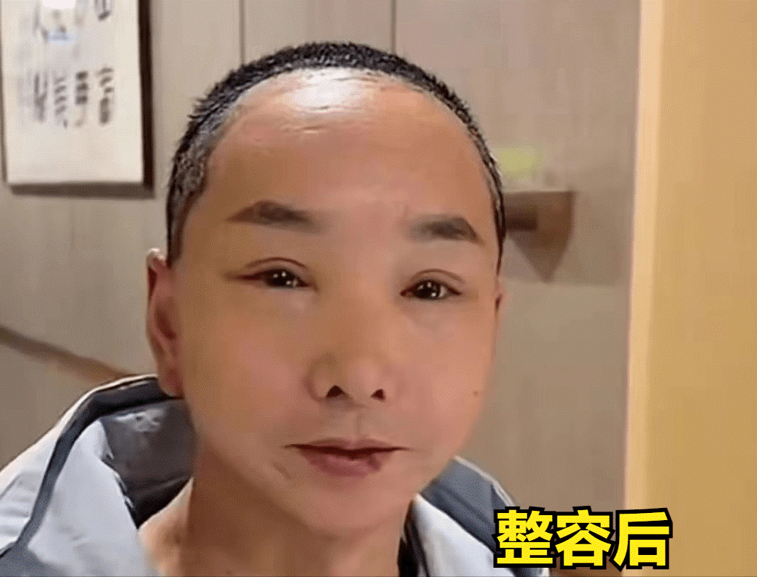 bi nham thanh ong noi cua con nguoi dan ong chi tien khung de cang da mat va cai ket gay choang1 bi nham thanh ong noi cua con nguoi dan ong chi tien khung de cang da mat va cai ket gay choang1