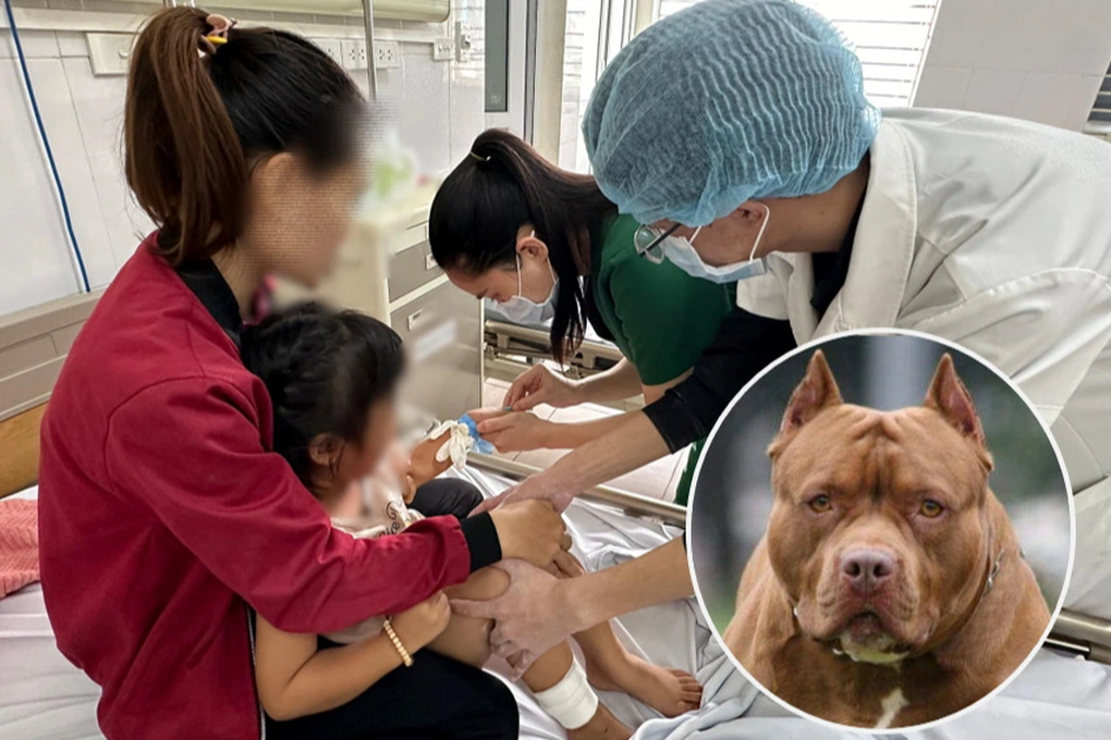 be gai 4 tuoi bi cho pitbull dai tan cong phai khau hang chuc mui tren mat