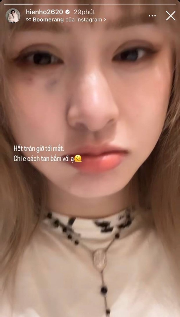 hien ho xuat hien voi vet bam lon tren mat noi mot cau khien khan gia tho dai ngao ngan3