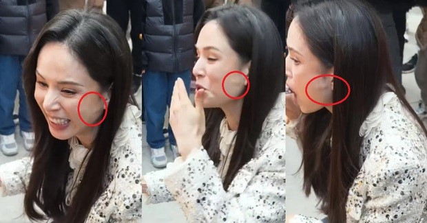 ly nhuoc dong dinh nghi van dao keo tren khuon mat nhung su that lai khien ai nay xot xa3