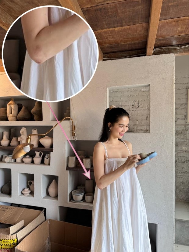 ngoc trinh ngam ngui chia se tinh trang nhung vet thuong sau 4 thang gap tai nan lai xe mo to1 ngoc trinh ngam ngui chia se tinh trang nhung vet thuong sau 4 thang gap tai nan lai xe mo to1
